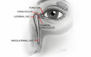 tear duct 300x188 1