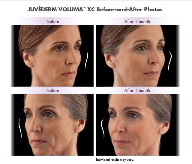 Voluma 1