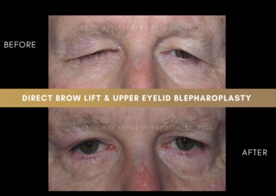 Corrective plastic surgery photos 4
