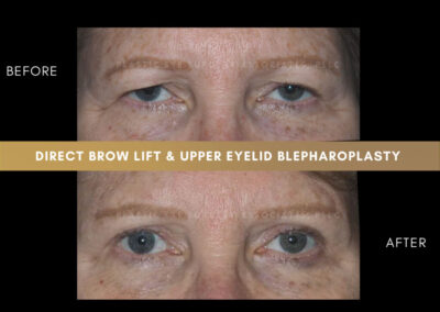 Corrective plastic surgery photos 5