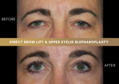 Corrective plastic surgery photos 1
