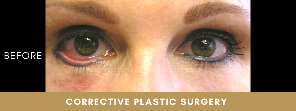 Corrective Plastic Surgery 1 Corrective Plastic Surgery 1