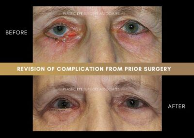 Photos of Complications 23