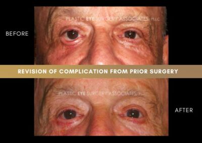 Photos of Complications 13
