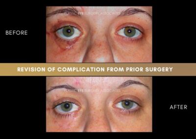 Photos of Complications 11