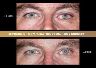Photos of Complications 10
