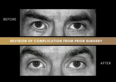Photos of Complications 8