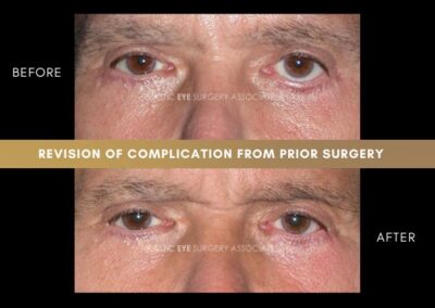 Photos of Complications 7