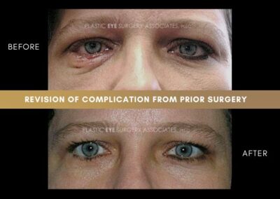 Photos of Complications 6
