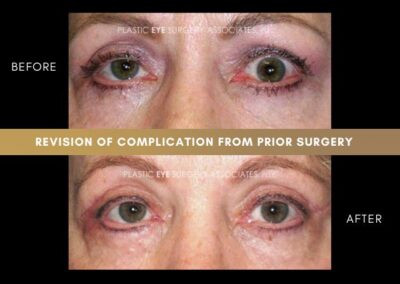 Photos of Complications 5