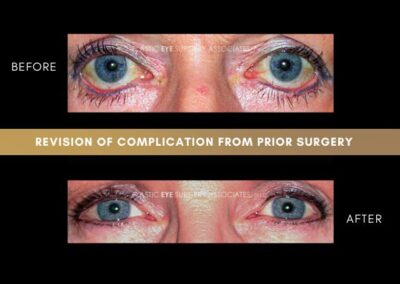 Photos of Complications 22