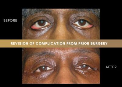 Photos of Complications 1