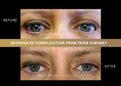 Photos of Complications 20