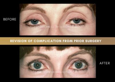 Photos of Complications 19