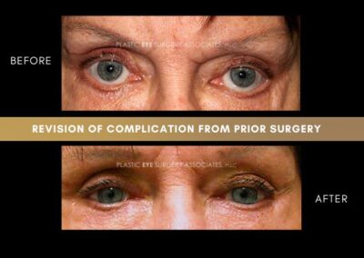 Photos of Complications 18
