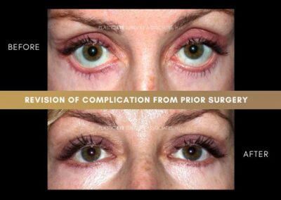 Photos of Complications 17