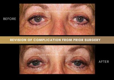 Photos of Complications 16